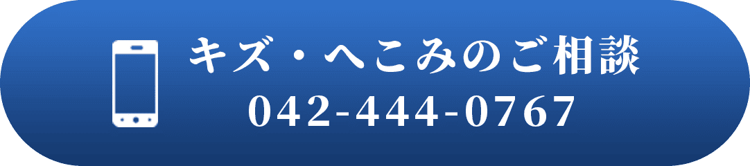 キズ・へこみのご相談 TEL 042-444-0767